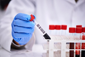 Меры профилактики новой  коронавирусной инфекции COVID-2019