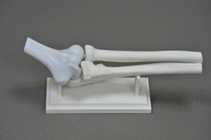 Нужен сустав? Напечатаем!